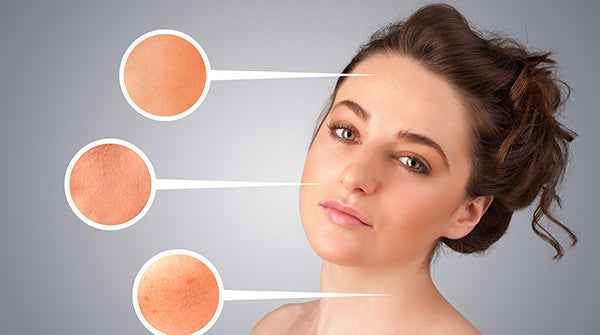 Understanding Your Skin Type Understanding Your Skin Type